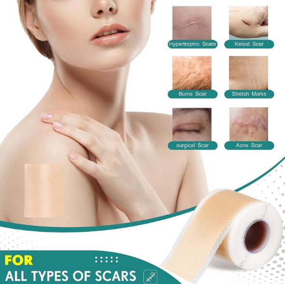 Maviglow® Silicone gel self-adhesive scar patch