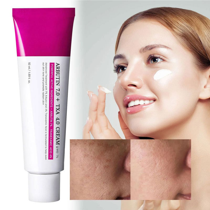 Arbutin 7% + Tranexamic Acid 4% Cream