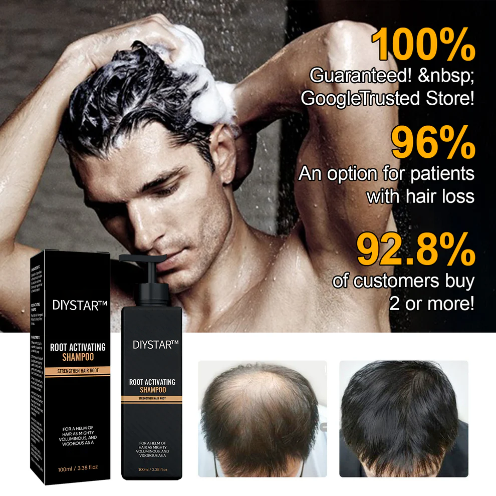 Easter Sale Countdown!⏰DIYSTAR™Root Activator Shampoo- Regain a full head of hair in just 6 weeks!