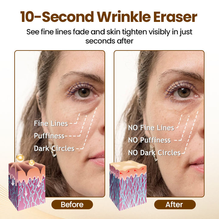 Lift10 - Erase Wrinkles in 10 Seconds + 50% OFF