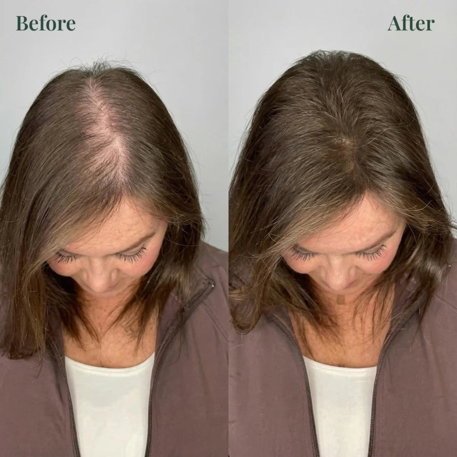  Unlock Thick, Lush Hair That Feels Alive and Strong Every Day