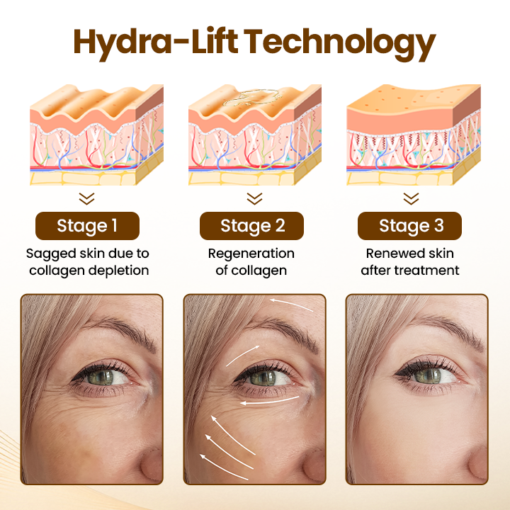 Lift10 - Erase Wrinkles in 10 Seconds + 50% OFF