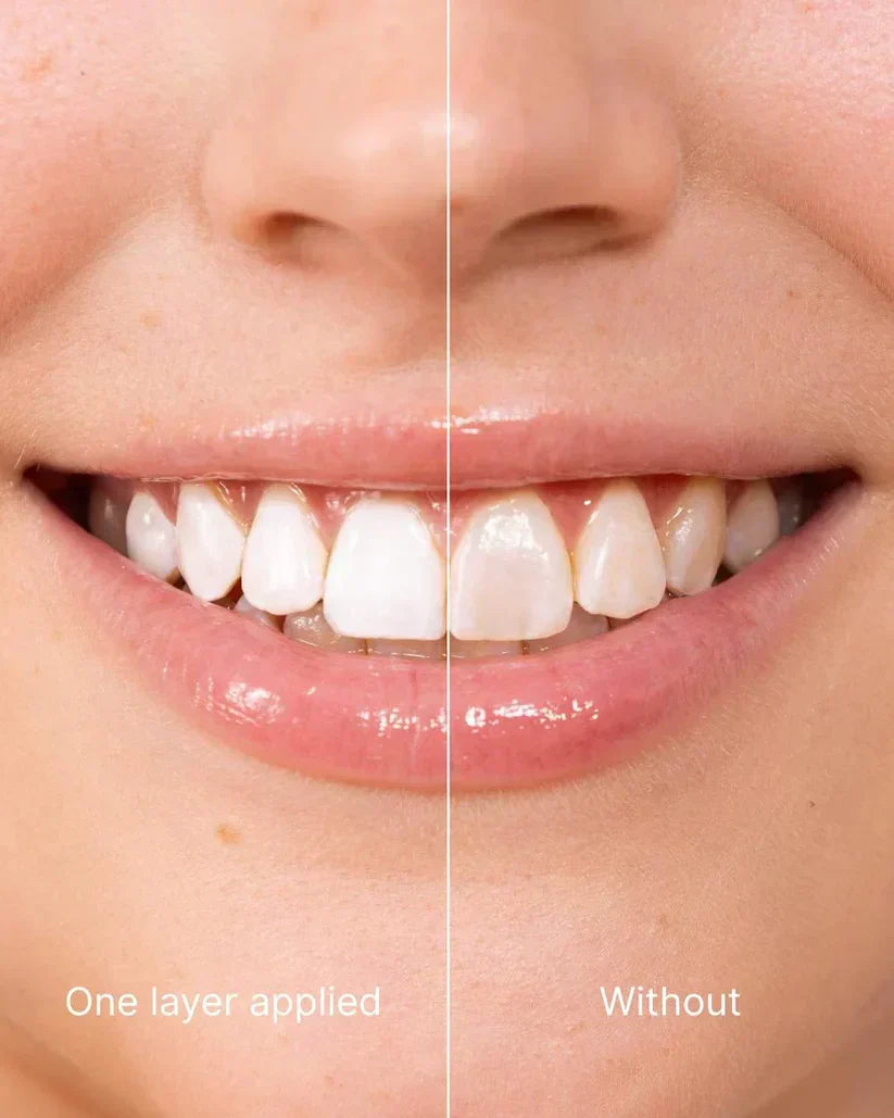 Smileasego™ Tooth Whitening - Instant Clean Smile