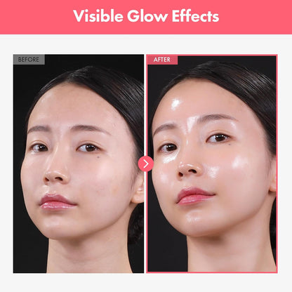 Arbutin 7% + Tranexamic Acid 4% Cream