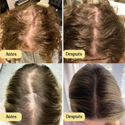 Veganic: Your natural oil treatment for hair growth.