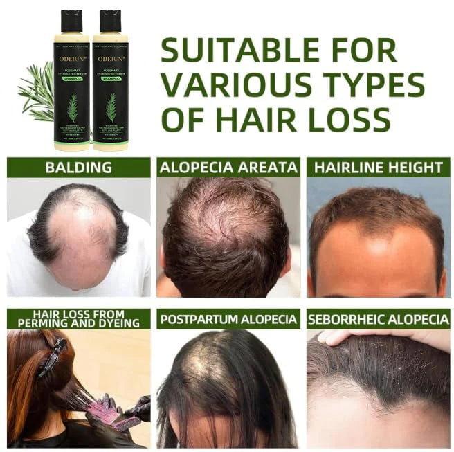  Unlock Thick, Lush Hair That Feels Alive and Strong Every Day