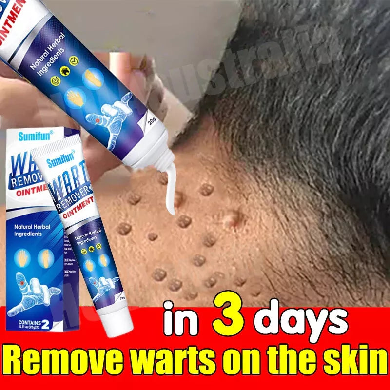 WartAway Herbal Removal Cream