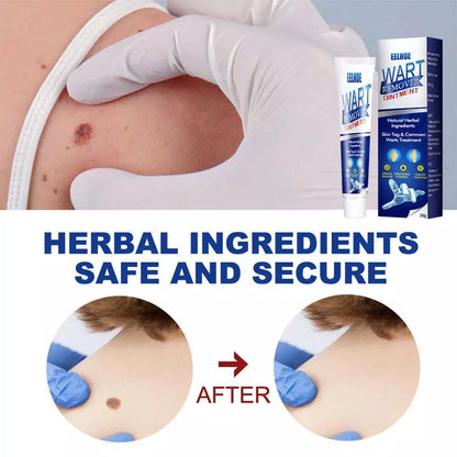 WartAway Herbal Removal Cream
